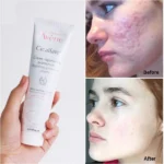 قیمت کرم ترمیم کننده سیکالفیت پلاس اون Avene