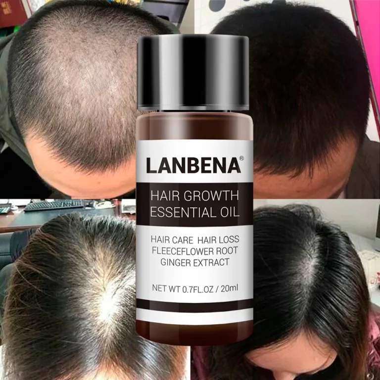 روغن رشد و تقویت مو لانبنا LANBENA