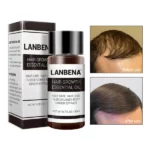 روغن رشد و تقویت مو لانبنا LANBENA