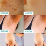 قیمت سرم روشن‌کننده و لایه‌بردار بدن AHA