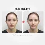 تست ست کرم و دستگاه جوانساز EMS مدی‌تراپی شومانگ