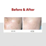 خرید کرم ضد لک و روشن‌کننده ملانو ایکس مدی‌پیلMEDI‑PEEL