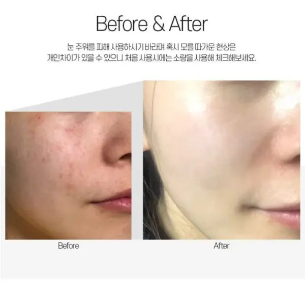 قیمت مزو کرم تسکین‌دهنده و ترمیم‌کننده سنتلا مدی‌پیلMEDI‑PEEL